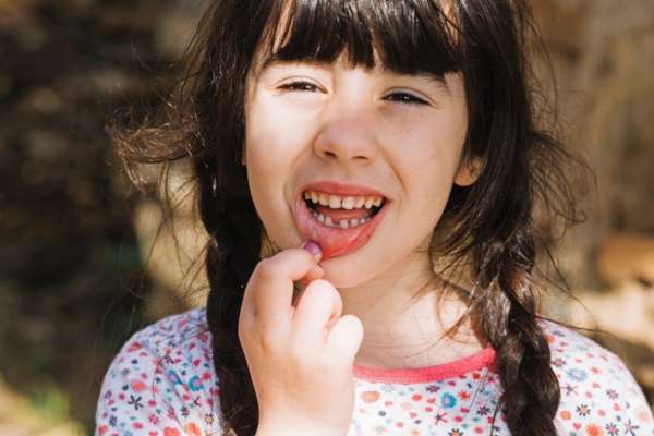 Los problemas dentales más comunes en niños