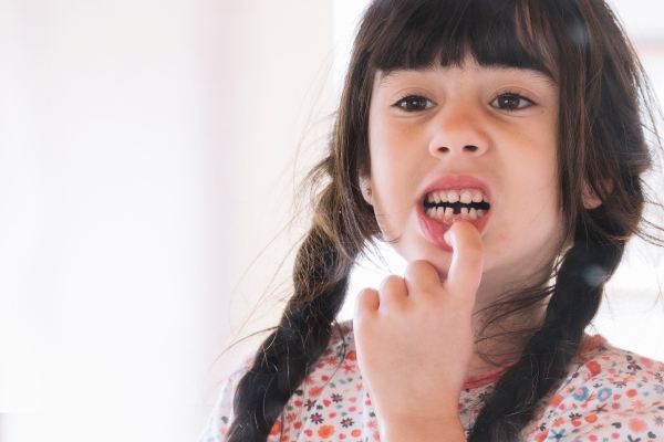 ¿Por qué es importante cuidar los dientes de leche?