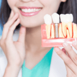 Poner implantes dentales duele